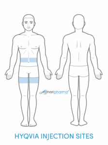 Injection sites for Hyqvia