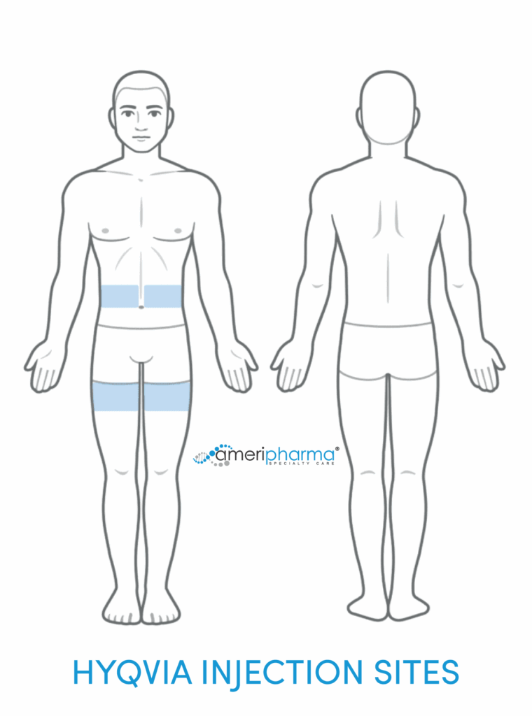 Injection sites for Hyqvia