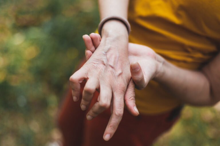 A woman holding her hand in pain