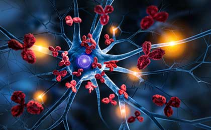 Damaged nerve signals