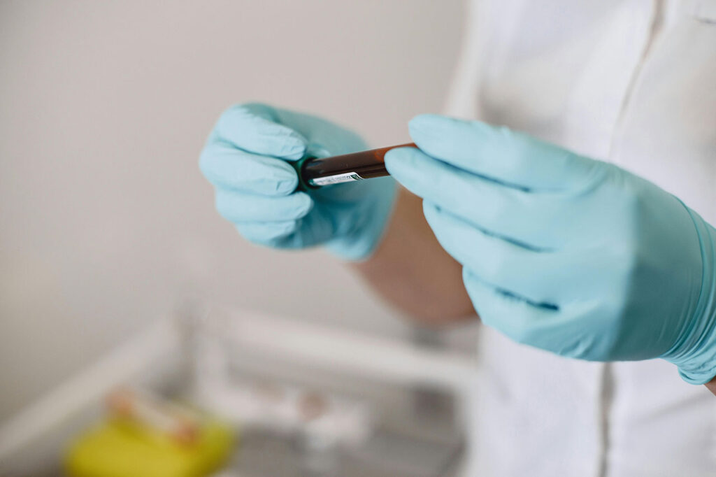 A gloved hand holding a blood sample