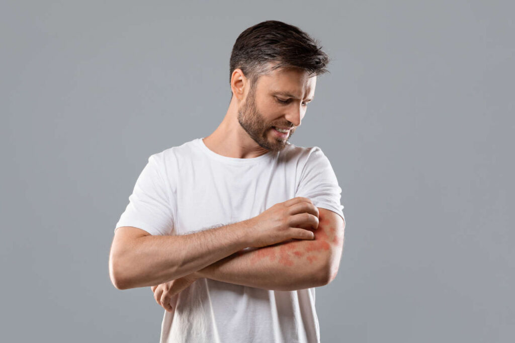 Tremfya Rash Tremfya (Guselkumab): A Biologic Treatment for Psoriasis