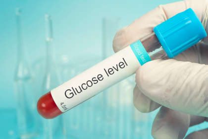 Scientist hold a sample tube of Glucose test to measure TPN metabolic complications. 