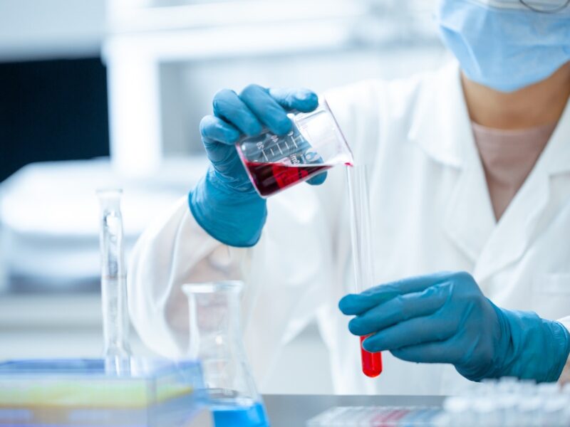 Blood testing in a laboratory