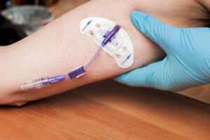 Doctor checks the PICC line on the arm of a patient