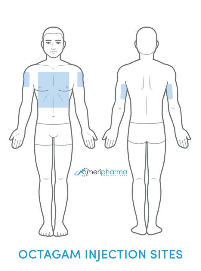 Octagam injection sites
