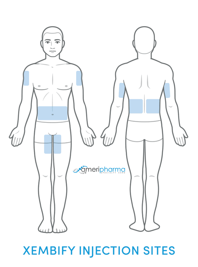 Xembify injection sites