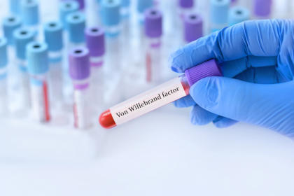 Doctor's hand holding a test tube with a blood sample