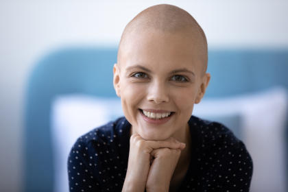 Smiling young woman with a bald head, resting chin on her hands