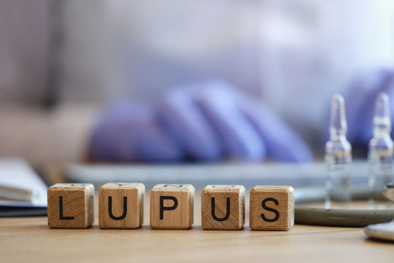 Close-up of word lupus collected of wooden cubes in doctor's office