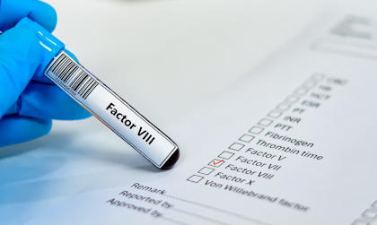Blood sample tube and paper order request for factor VIII test analysis