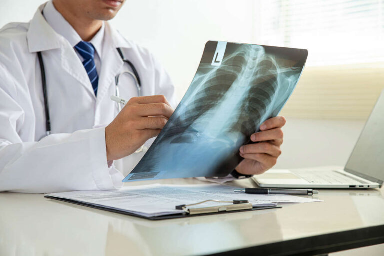 Doctor reviewing x-ray of a patient on ARALAST