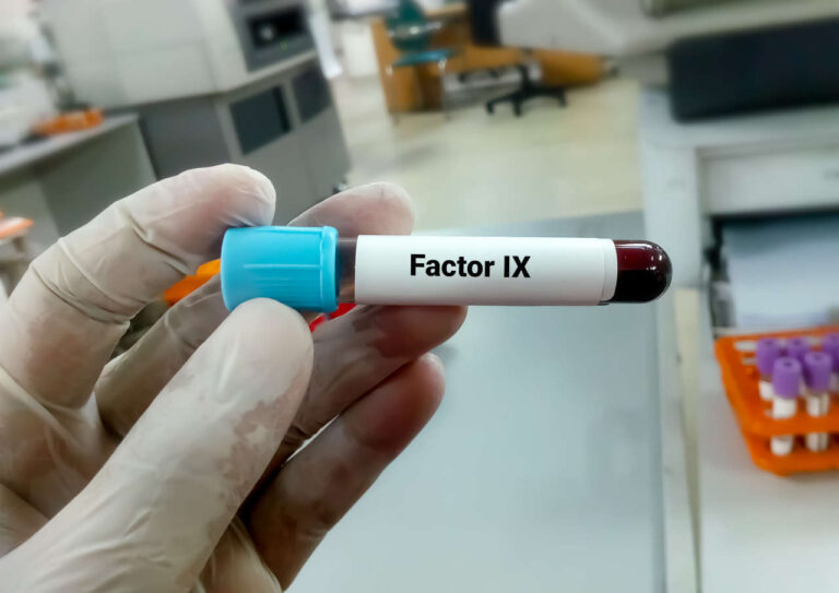 Test tube with factor IX being held by a lab technician