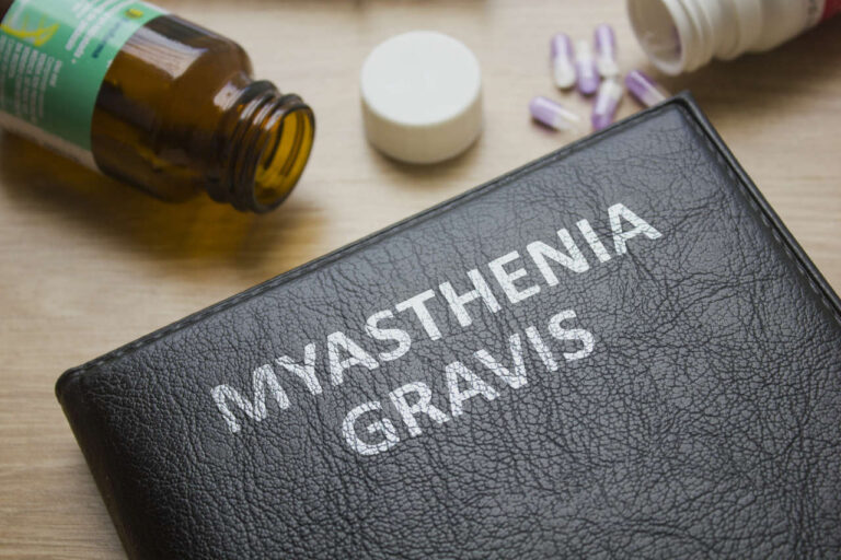 Doctor's desk with a myasthenia gravis handbook