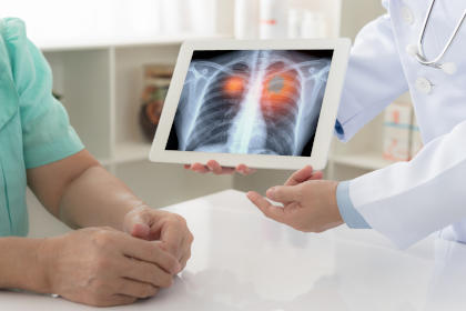Doctor showing a patient a lung x-ray